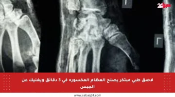 لاصق طبي مبتكر يصلح العظام المكسورة في 3 دقائق ويغنيك عن الجبس